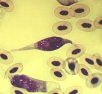 دانلود رايگان سوالات آزمون كارشناسي ارشد انگل شناسی پزشکی