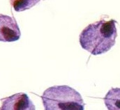 ظرفیت پذیرش کارشناسی ارشدقارچ شناسی پزشکی